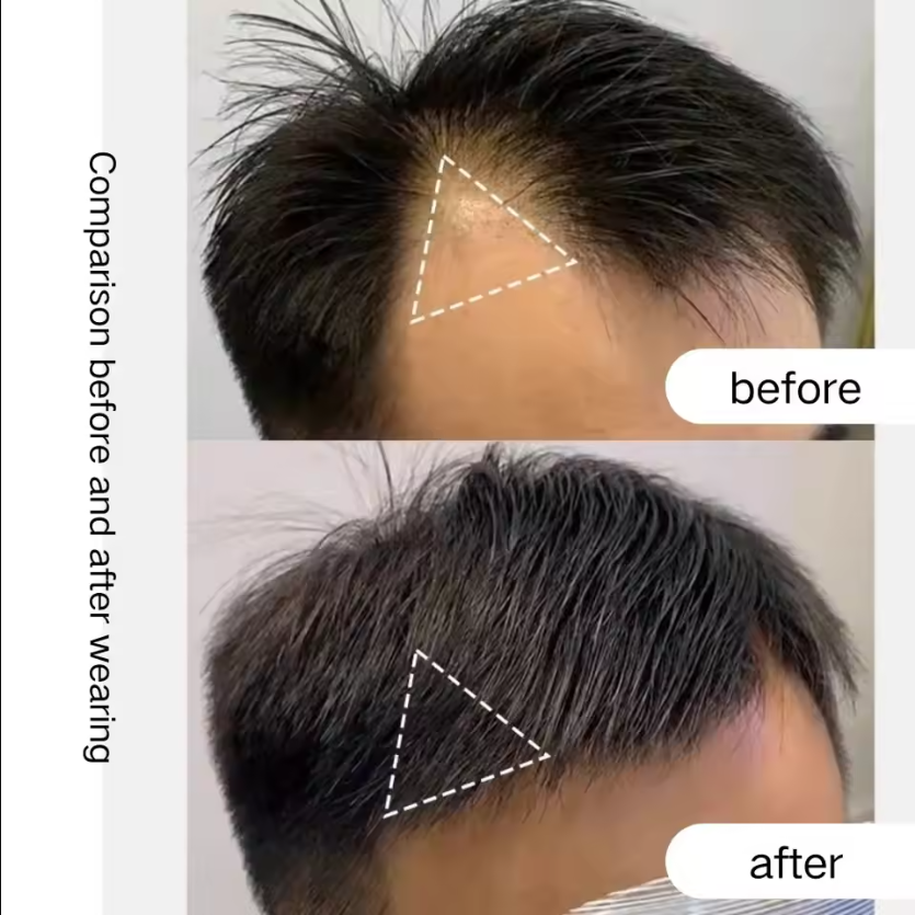 3*3 6-Inch Front Hairline Invisible Hair Replacem