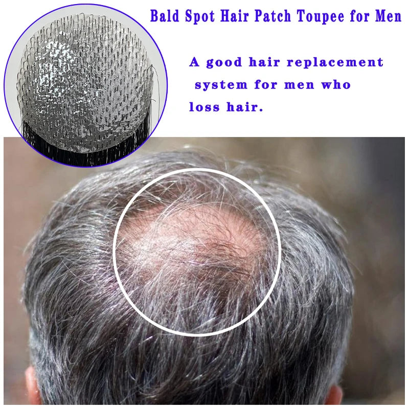 Top of the head Hairpiece Scar Patch