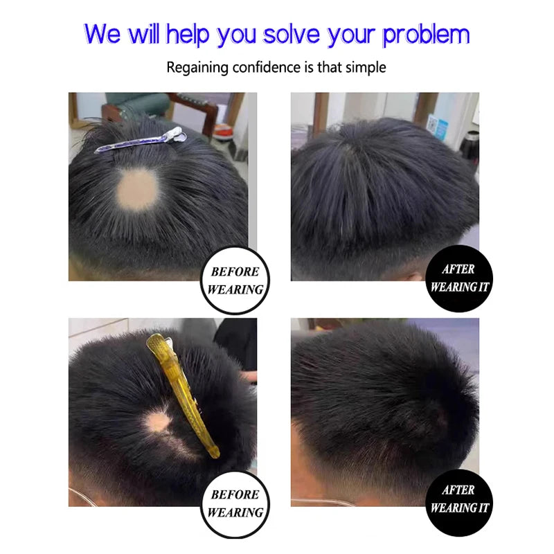 Top of the head Hairpiece Scar Patch