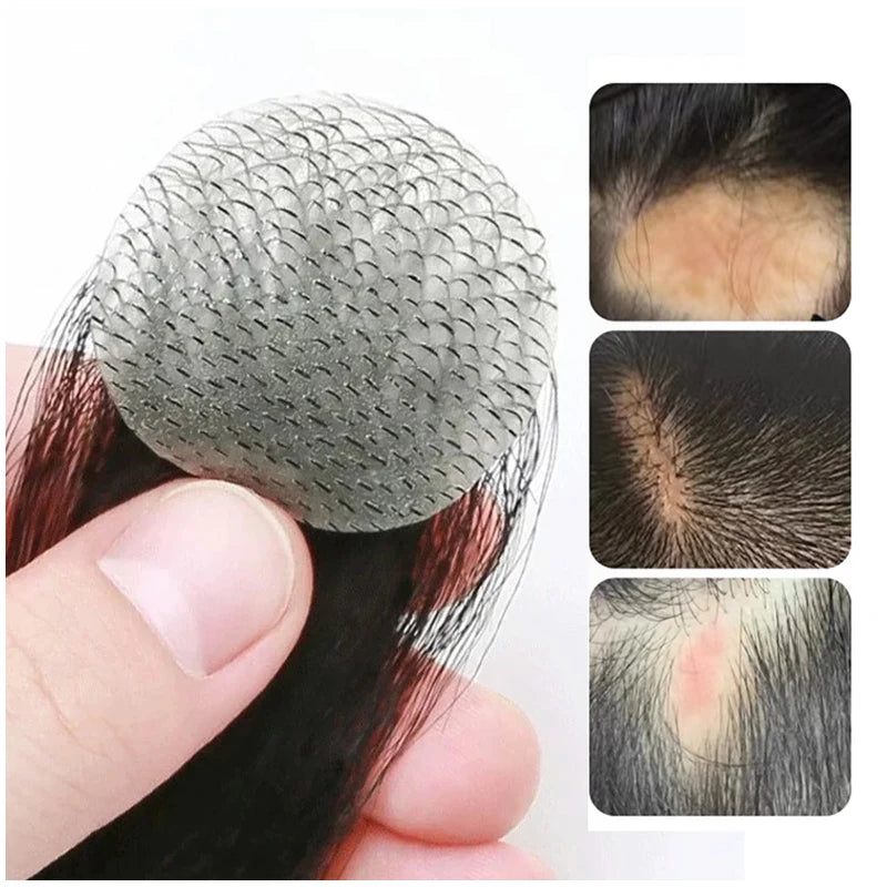 Top of the head Hairpiece Scar Patch